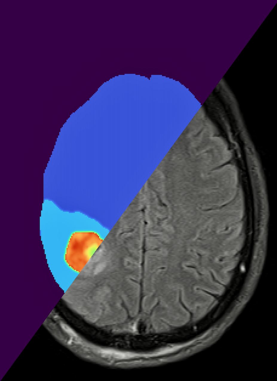 A human brain and its digital twin.