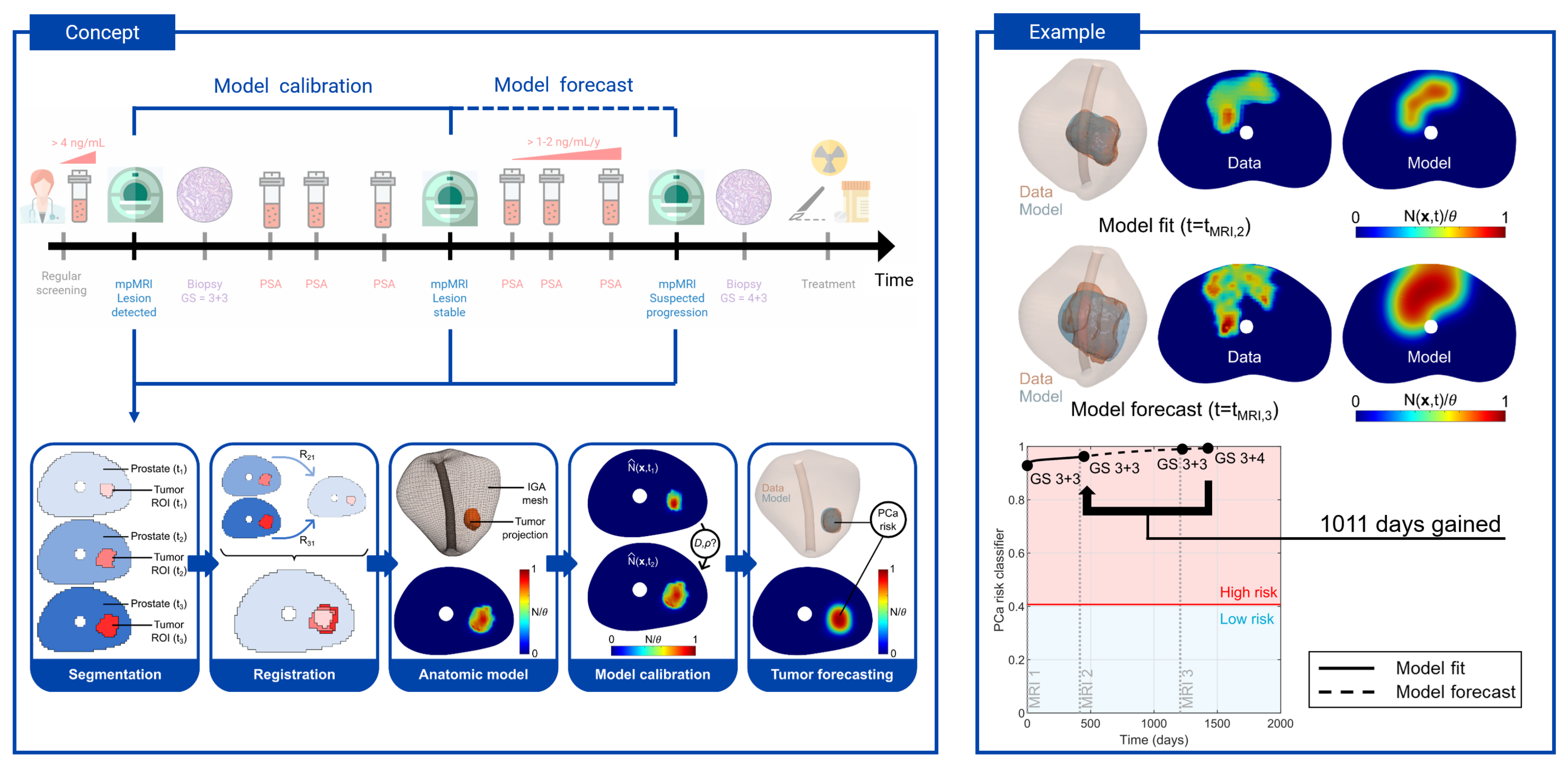 Using Biomechanistic Modeling, Researchers Predict Prostate Cancer Growth