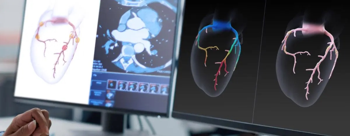 HeartFlow's AI-powered medical technology debuts on Nasdaq