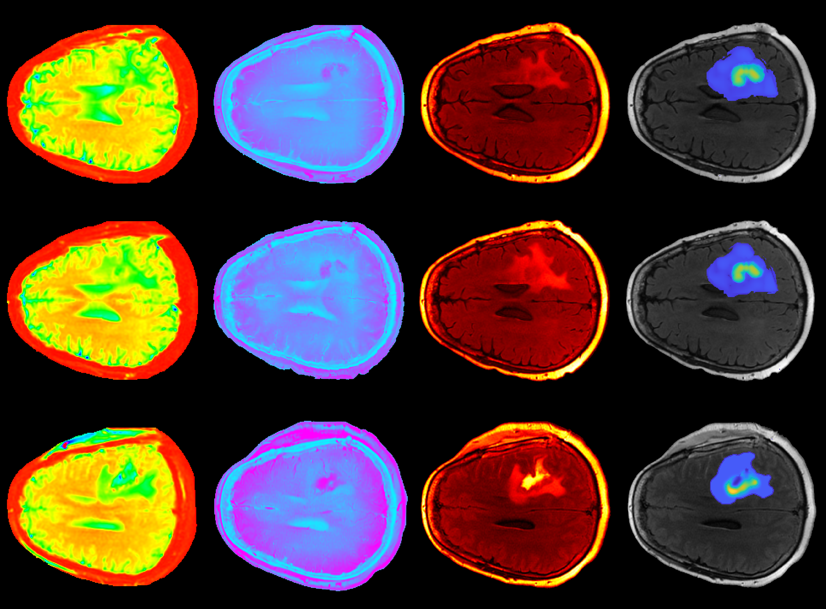 UT Austin and MD Anderson Awarded CPRIT Funding to Advance Oncological Data and Computational Science Collaboration